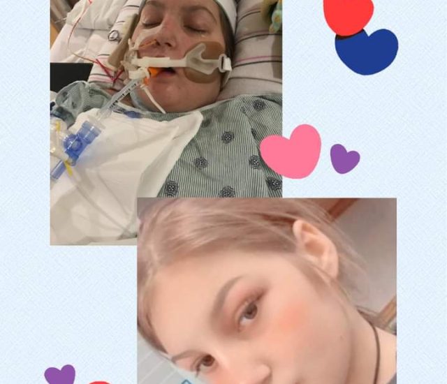 Ava on Ecmo / life support